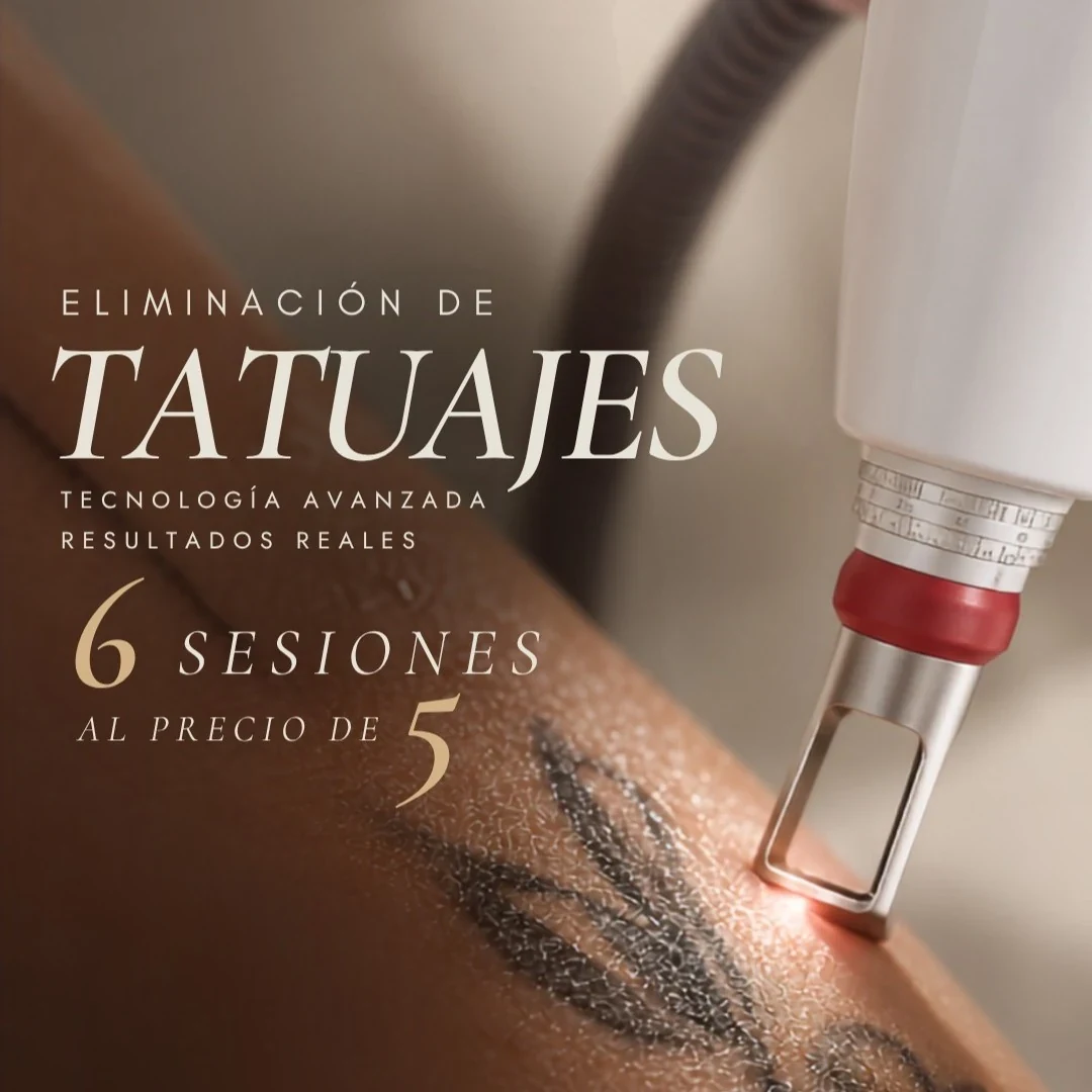 Tatuajes 6 Sesiones a solo 5
